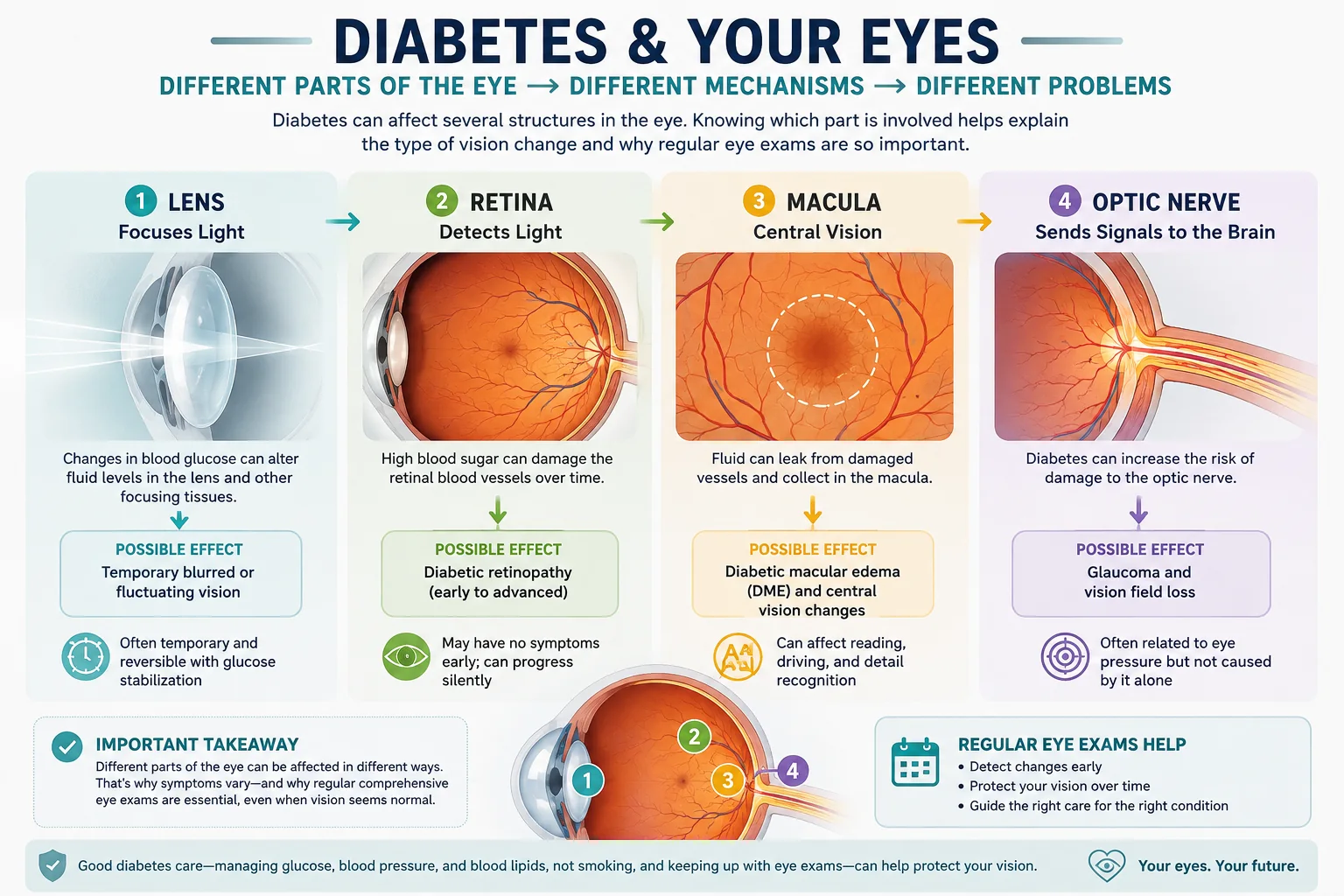 Infographic showing how diabetes can affect the lens, retina, macula and optic nerve through different mechanisms