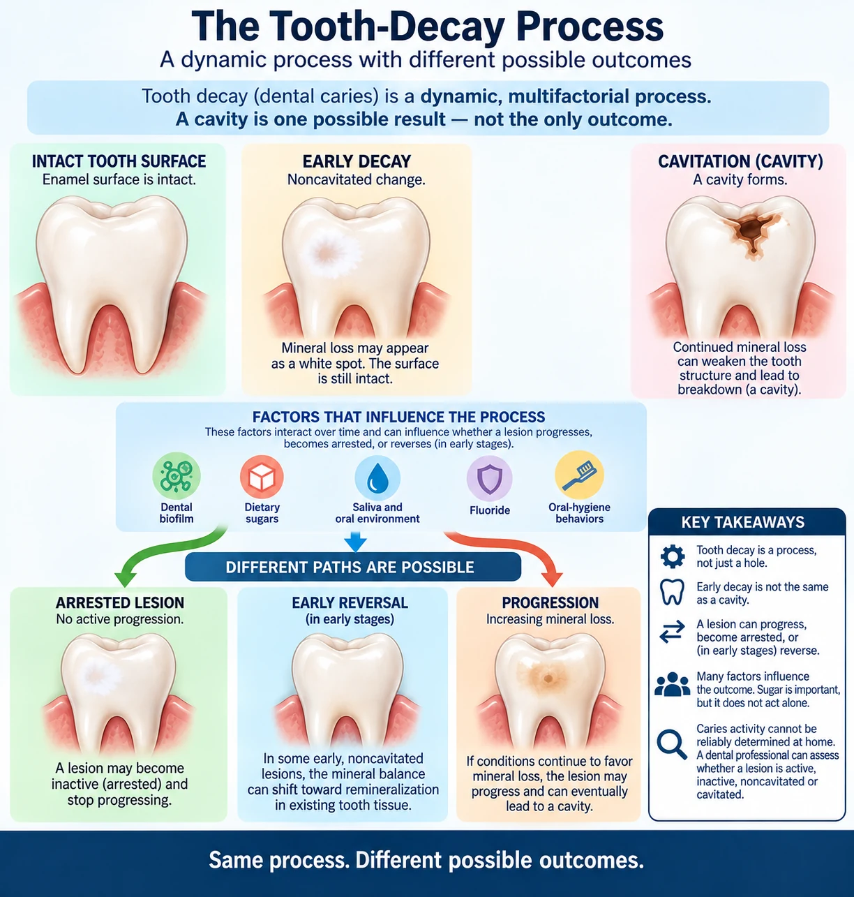Infographic explaining tooth decay as a dynamic process, showing early noncavitated decay and possible arrest, early reversal, progression, or cavitation